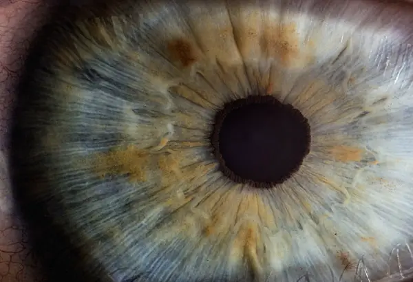 eye and iris closeup